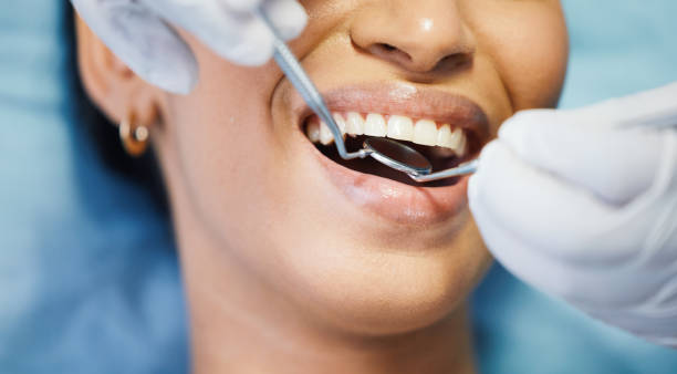 Best Urgent Care for Lost Fillings or Crowns in Janesville, CA